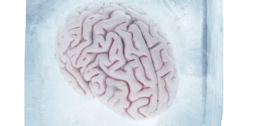 A Timeless Question Answered: What causes Brain Freeze?